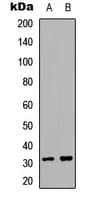 ACER2 Antibody (Internal)