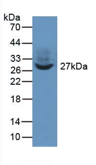 TWF1 / PTK9 Antibody (aa1-252)