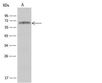 Polyclonal Rabbit anti-Human TRIM29 Antibody (WB)