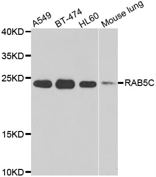 Polyclonal Rabbit anti-Human RAB5C Antibody (IHC, WB)