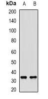 IHC-plus™ SULT1A1 / Sulfotransferase 1A1 Antibody