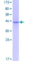 Human NUDT2 Protein (Recombinant GST)