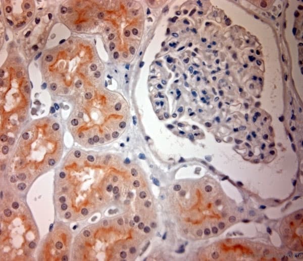 Polyclonal Rabbit anti-Human SLC17A3 Antibody (aa2-50, IHC)