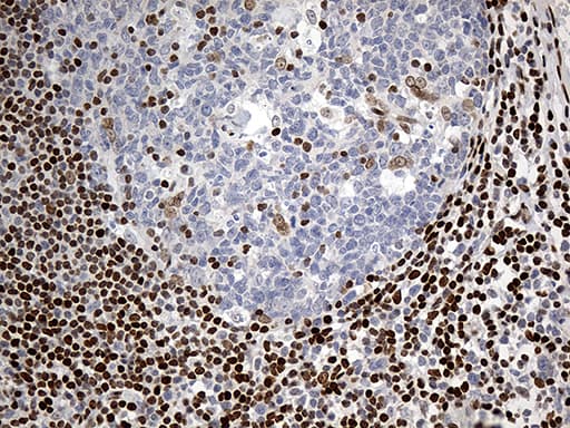 Monoclonal Mouse anti-Human MECP2 Antibody (clone OTI2F1, aa224-486, IHC, WB)