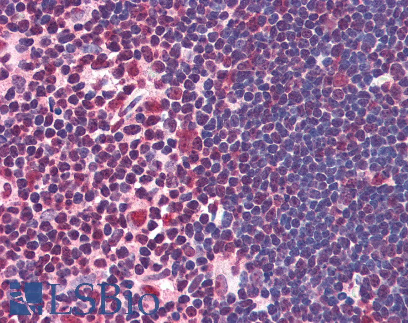 IHC-plus™ Polyclonal Goat anti-Human NF45 / ILF2 Antibody (aa355-367, IHC, WB)