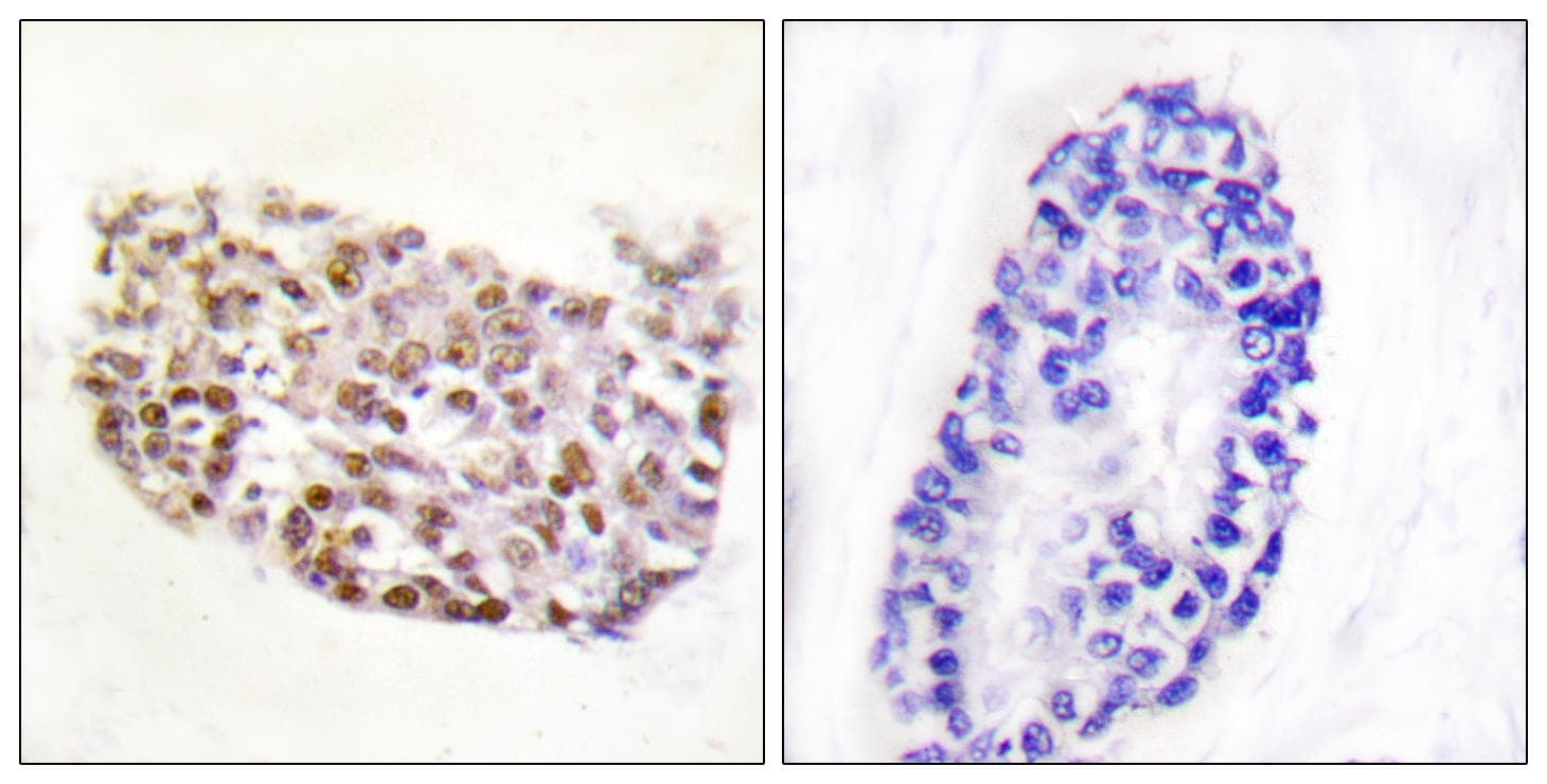 NFAT5 Antibody (Ab-1197)