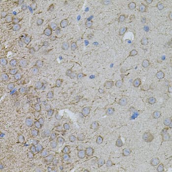 Polyclonal Rabbit anti-Human MMP10 Antibody (IHC, WB)
