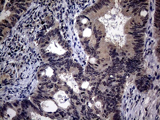 ITGB1 / Integrin Beta 1 / CD29 Antibody (clone OTI9B5)