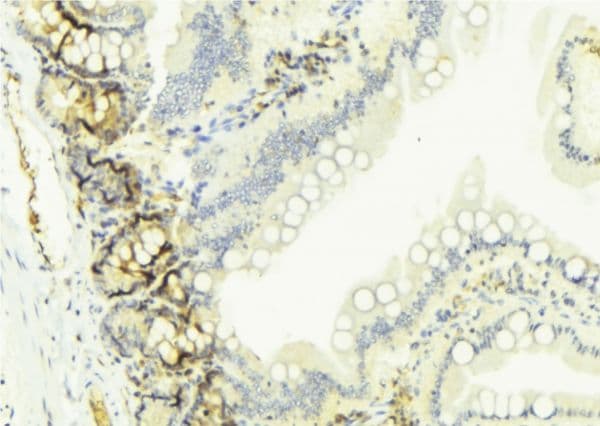 CYP2W1 Antibody