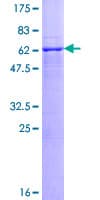 Human MIR16 / GDE1 Protein (Recombinant GST)