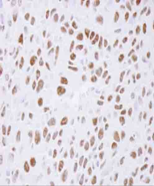IHC-plus™ TP53BP1 / 53BP1 Antibody (aa350-400)