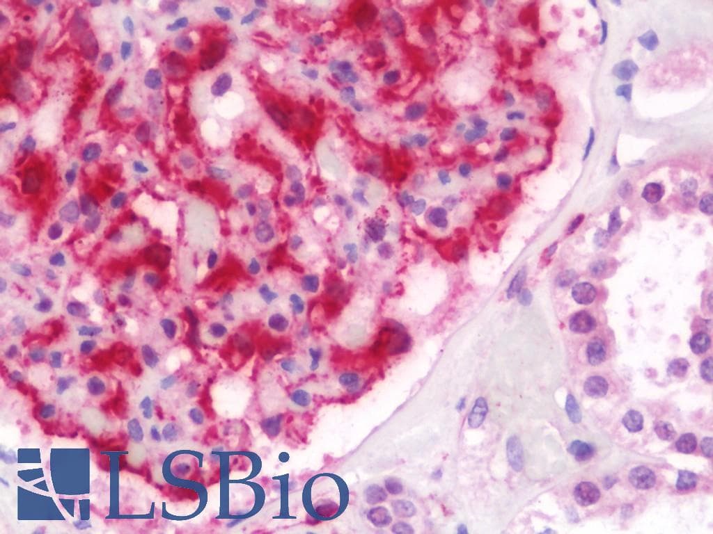 IHC-plus™ IFNA2 / Interferon Alpha 2 Antibody (aa125-188)