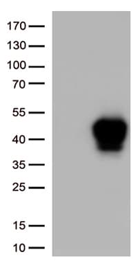 TNFRSF4 / CD134 / OX40 Antibody (clone UMAB276)