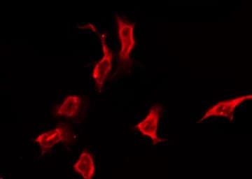 OR5K3 Antibody
