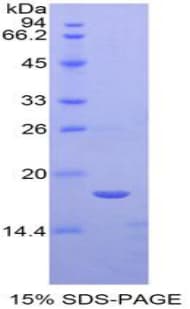 Mouse SEMA3A / Semaphorin 3A Protein (Recombinant His-T7)