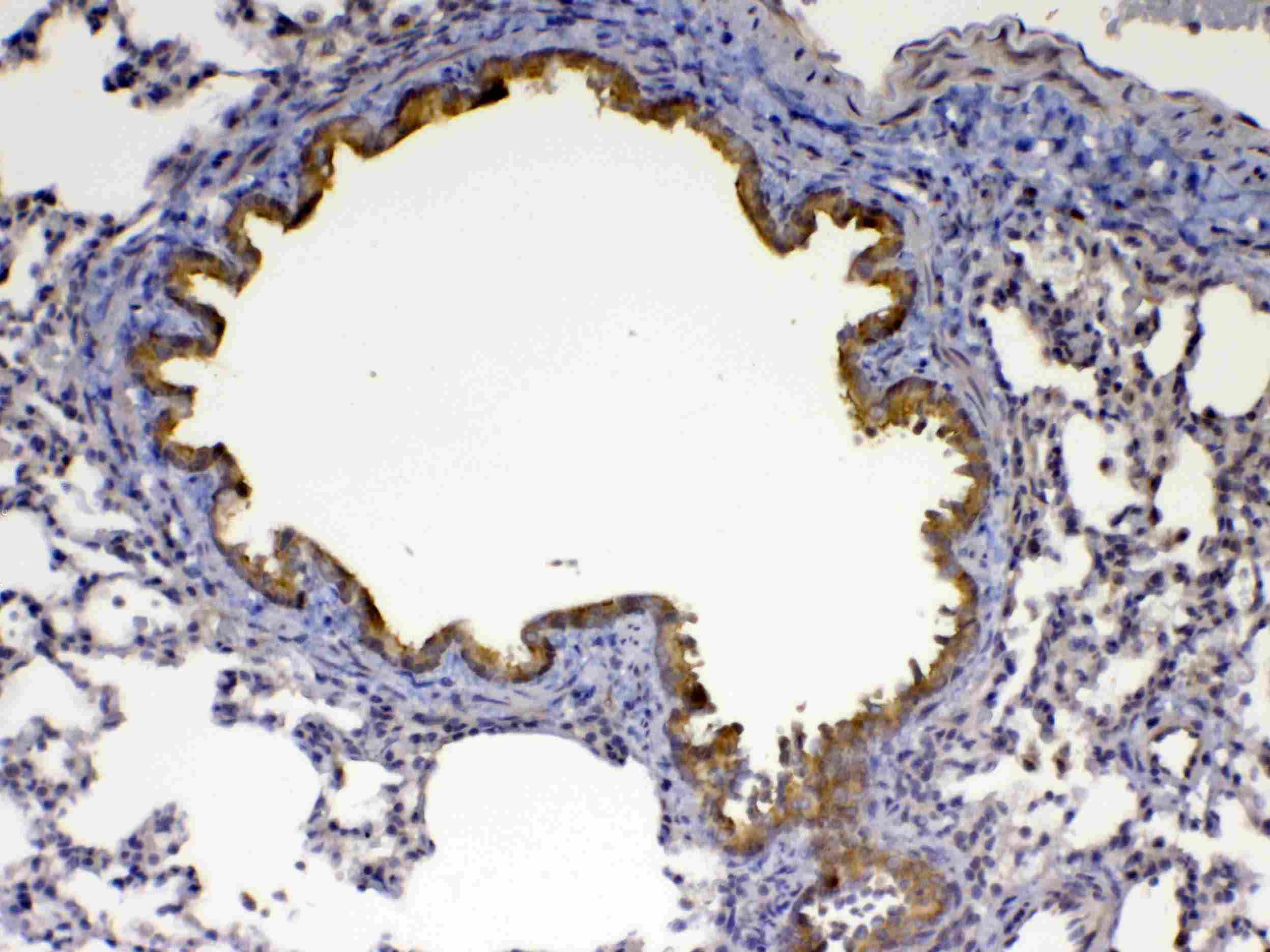 CFD / Factor D / Adipsin Antibody