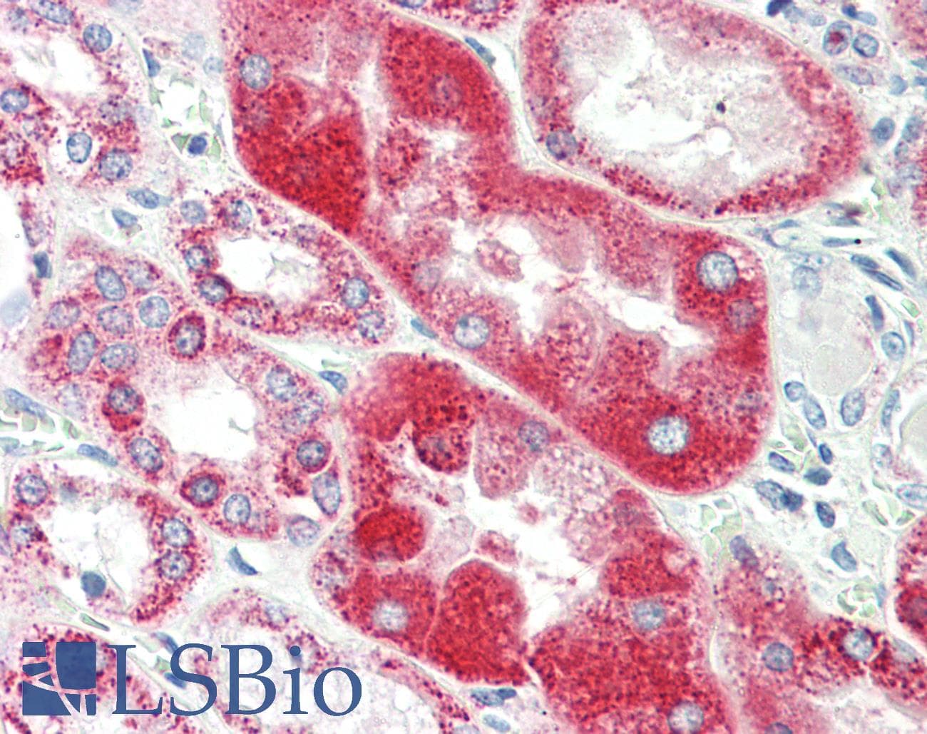 IHC-plus™ GLRA1/Glycine Receptor Alpha 1 Antibody (aa373-386)