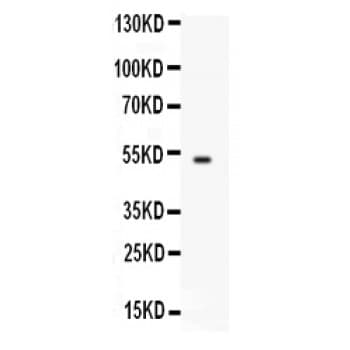 FCGRT / FCRN Antibody (aa56-291)