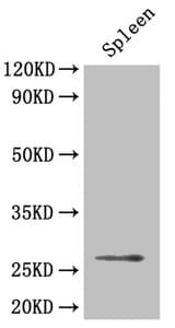 PathPlus™ BDNF Antibody