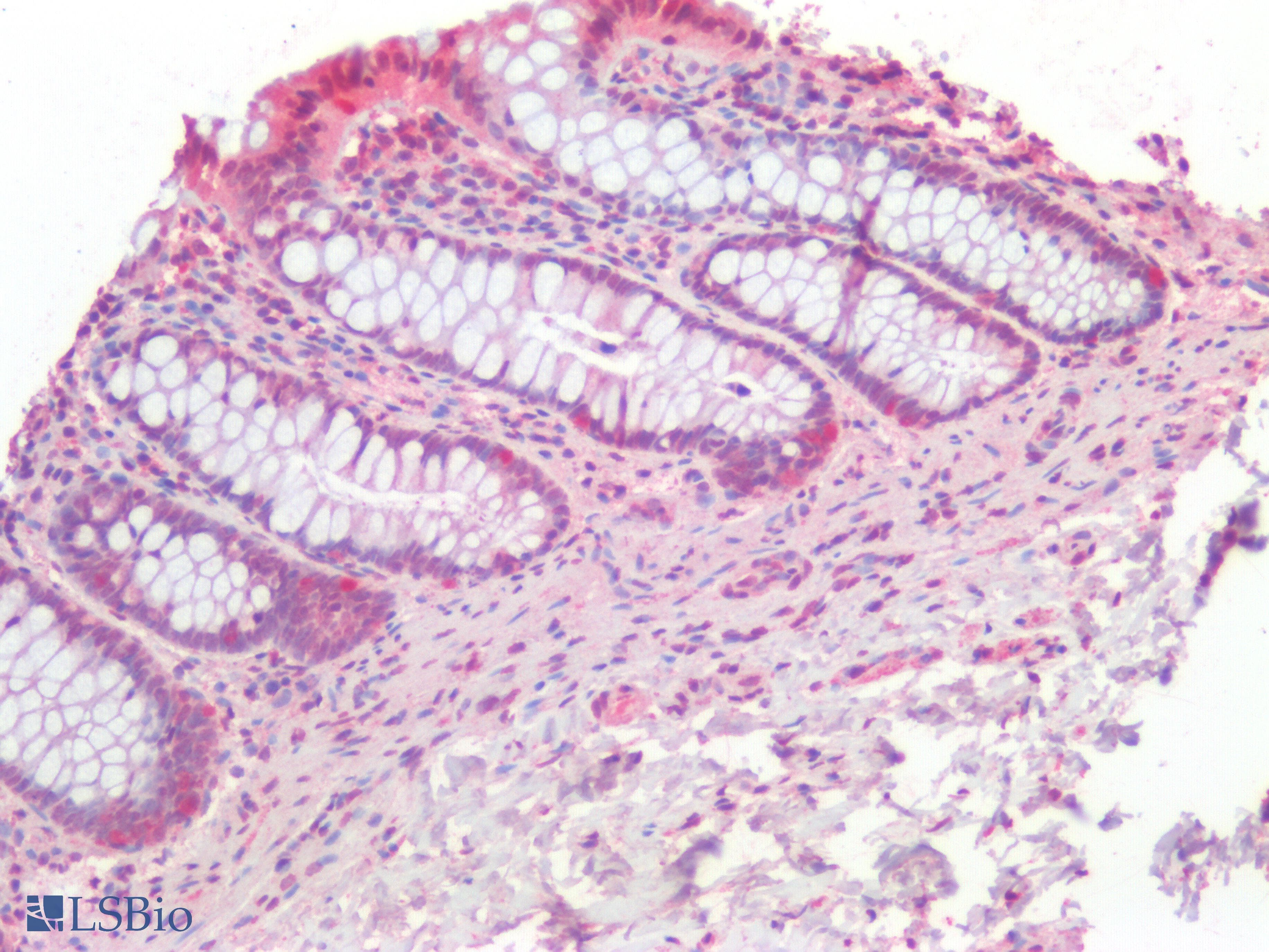 IHC-plus™ Polyclonal Rabbit anti-Human PIK3CA / PI3K Alpha Antibody (IHC)