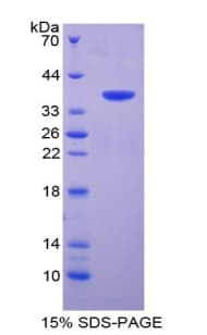 Rat T-Kininogen 1 Protein (Recombinant His-GST)