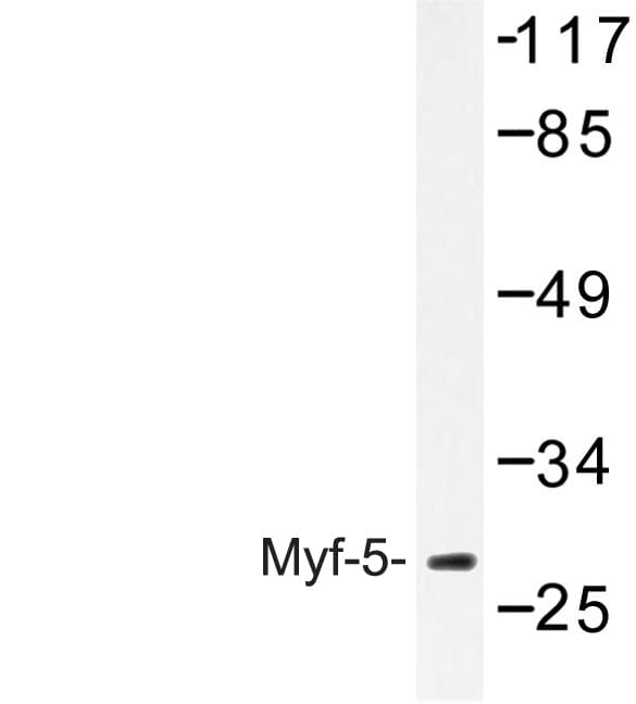 MYF5 / MYF 5 Antibody (Ala88)