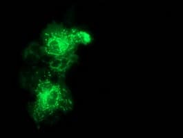MMAB Antibody (clone OTI3B8)