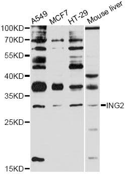 Polyclonal Rabbit anti-Human ING2 Antibody (WB)