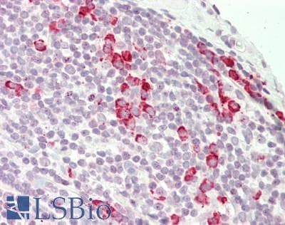 AREL1 / KIAA0317 Antibody (aa179-228)