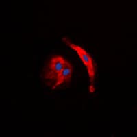 COL5A3 / Collagen V Alpha 3 Antibody (N-Terminus)