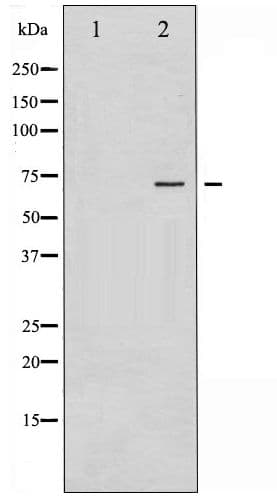 Polyclonal Rabbit anti-Human ER Alpha / Estrogen Receptor Antibody (phospho-Tyr537, IHC, WB)
