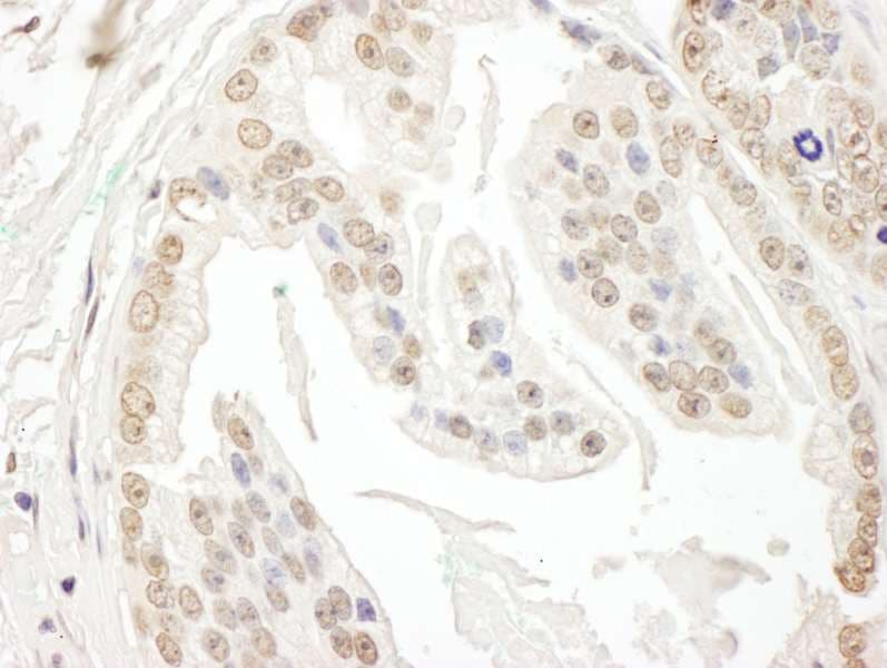 POLR3D Antibody (aa175-225)