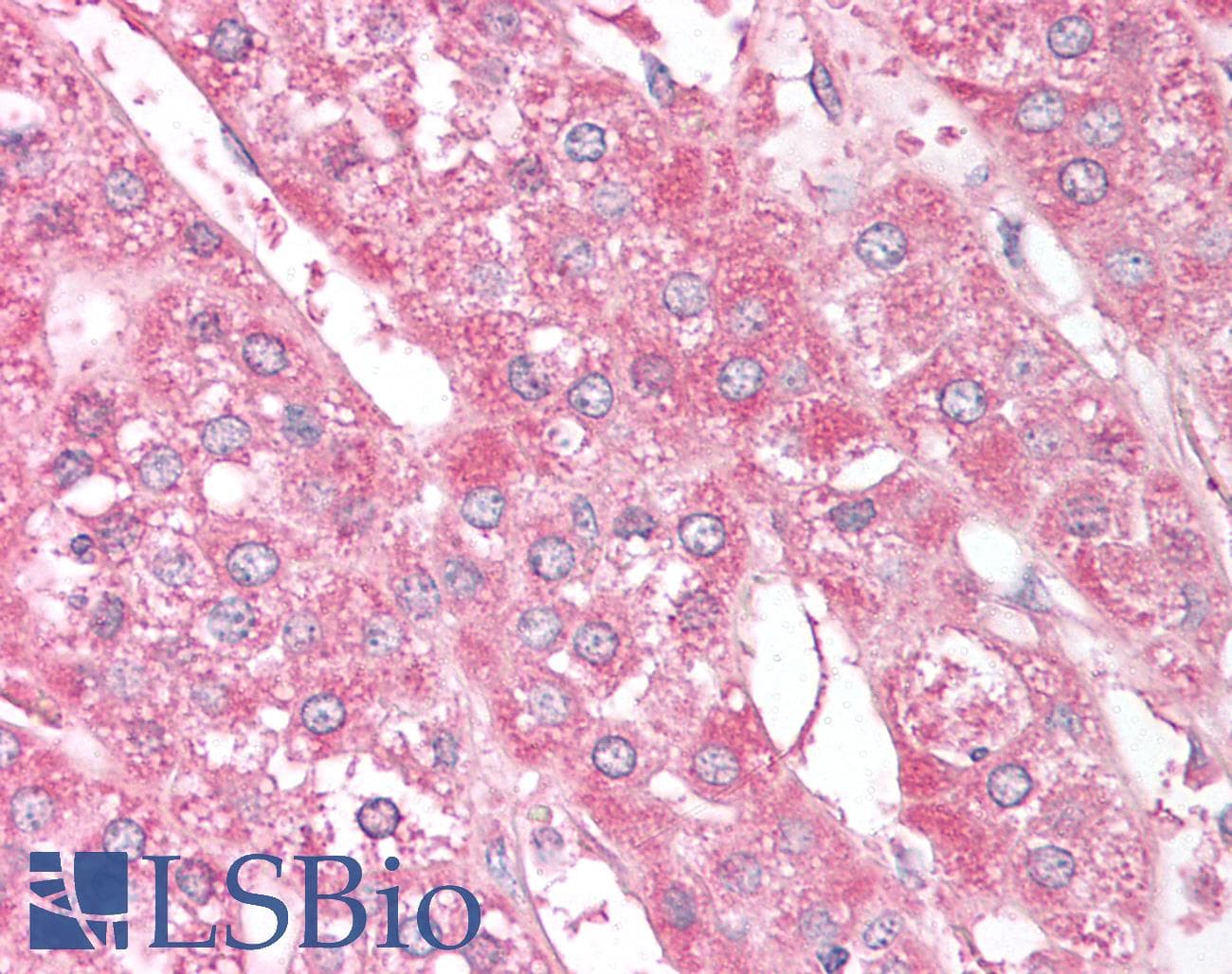IHC-plus™ ST13 Antibody (aa60-75)