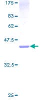 Human CENPA / CENP-A Protein (Recombinant GST)