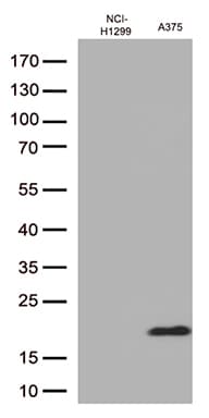 CTAG1B / NY-ESO-1 Antibody (clone UMAB73)