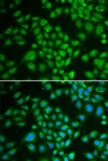IHC-plus™ DCK / Deoxycytidine kinase Antibody