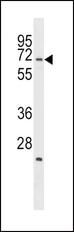 STK39 / SPAK Antibody (aa346-376)
