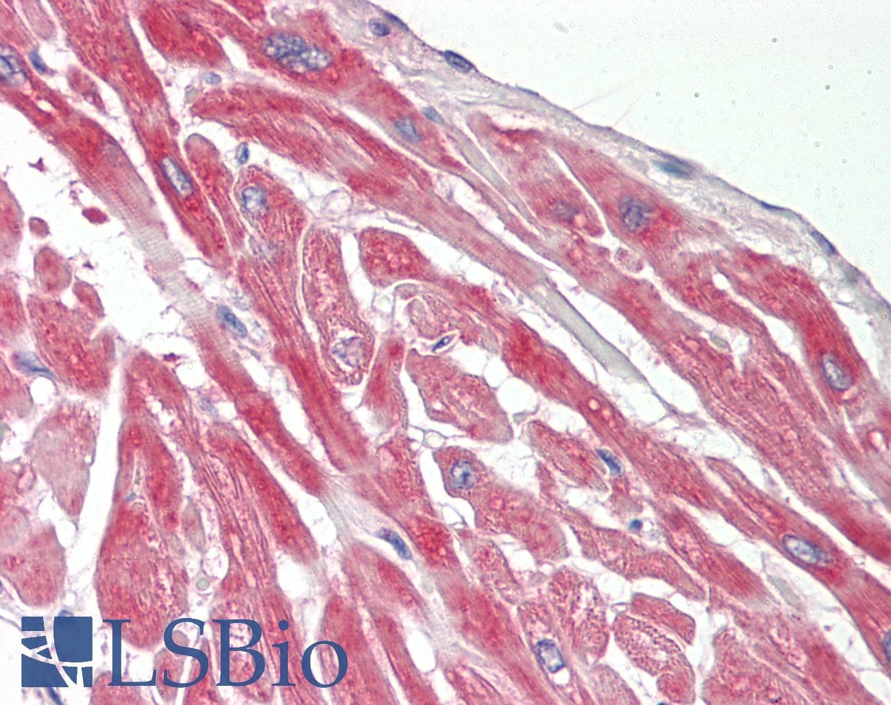 PRKACA Antibody (N-Terminus)