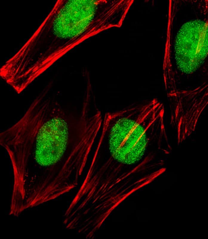 Polyclonal Rabbit anti-Human Tra1 / TRRAP Antibody (aa3015-3049, IF, WB)