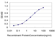 Monoclonal Mouse anti-Human ADH6 Antibody (clone 4G4, WB)
