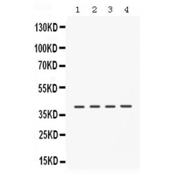 CSNK1A1 / CK1 Alpha Antibody (aa30-68)