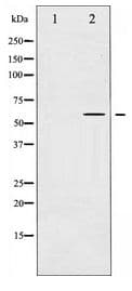 MAP3K8 / TPL2 Antibody