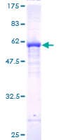 Human FBXO22 Protein (Recombinant GST)