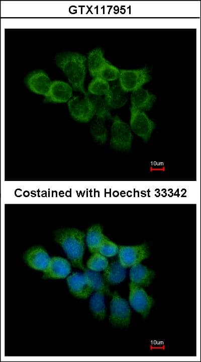 Polyclonal Rabbit anti-Human PPIF / Cyclophilin F Antibody (IHC, IF, WB)