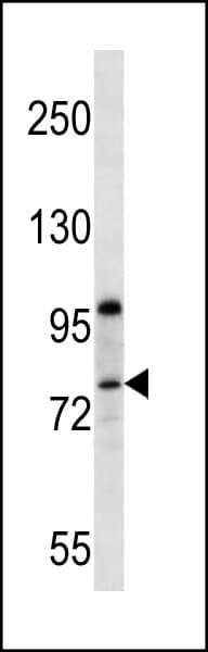 PPP1R15B Antibody (aa494-522)