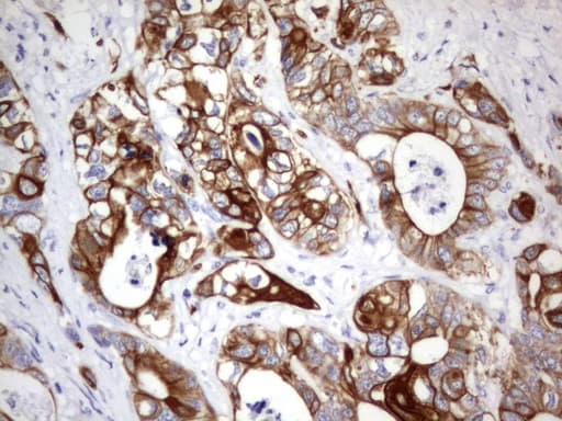Acidic Cytokeratin Antibody (clone 5F9)