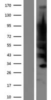JPH4 Protein (Over-Expression Lysate Myc-DDK (Flag))