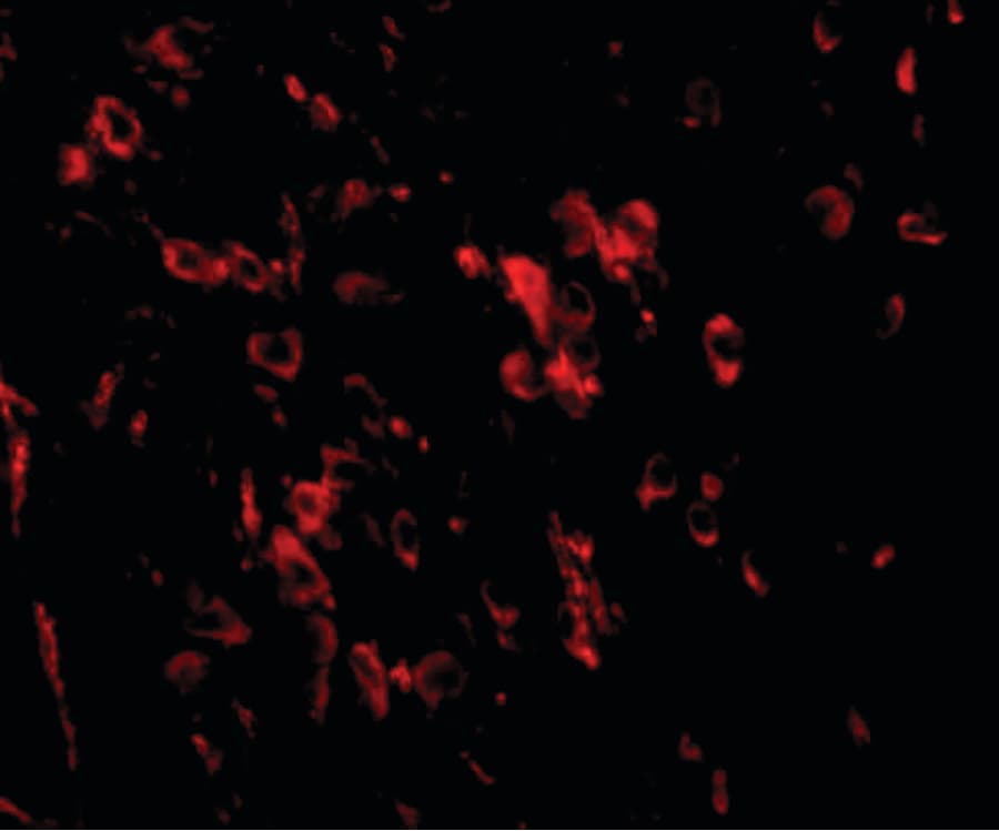 Polyclonal Rabbit anti-Human LRFN1 Antibody (IHC, IF, WB)