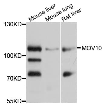 Polyclonal Rabbit anti-Human MOV10 Antibody (IHC, IF, WB)