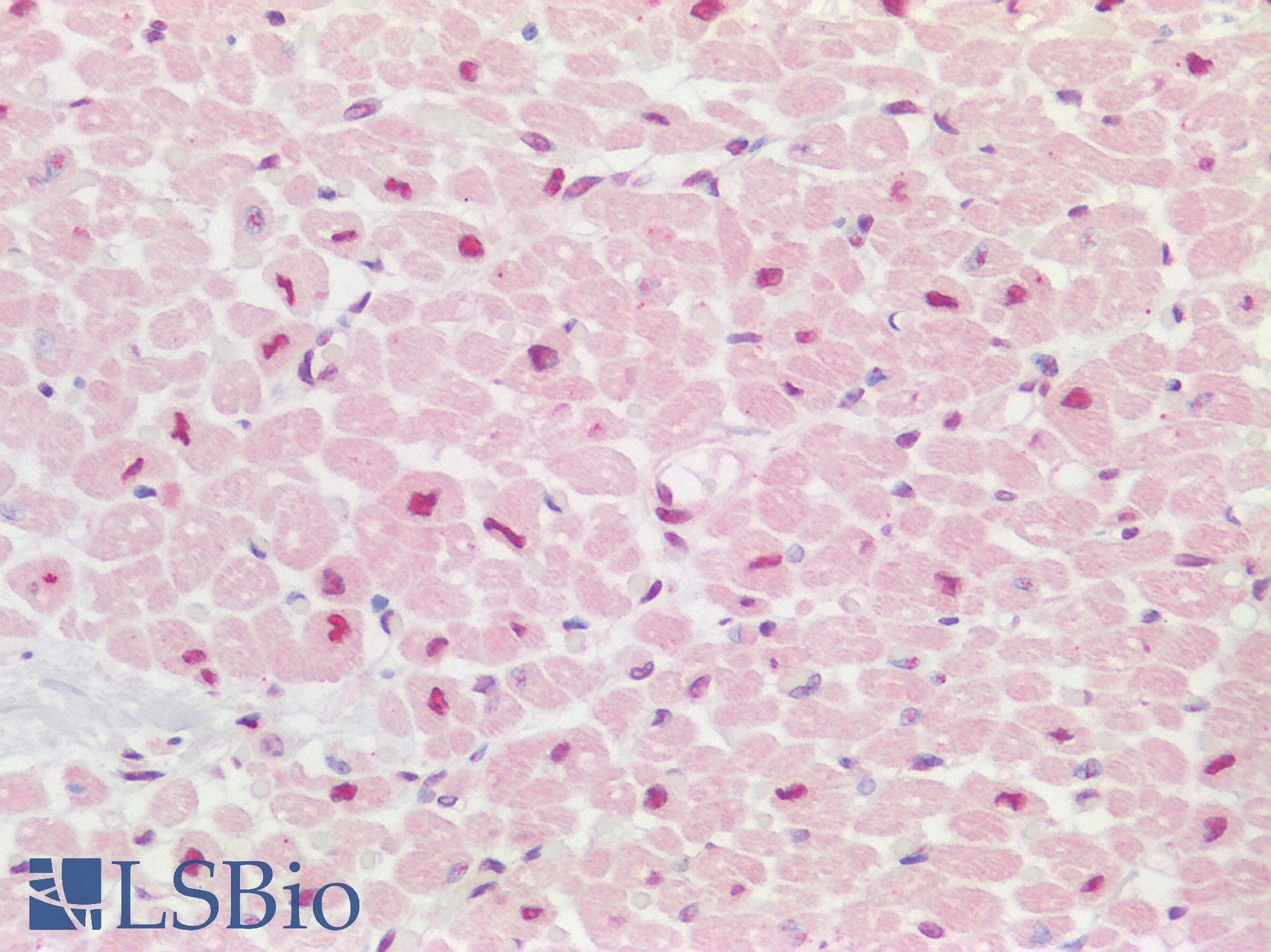 AATF Antibody (aa171-220)
